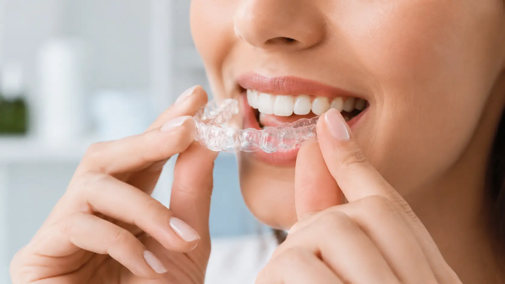 Apparecchio trasparente per allineare i denti a Castelvetrano