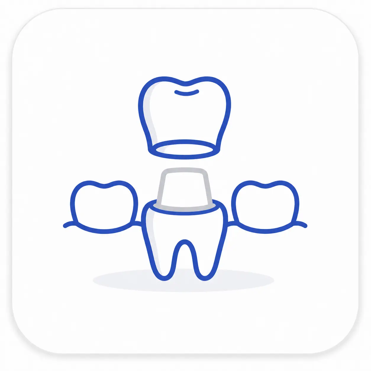 Protesi e corone dentali